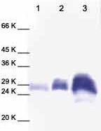 Western blot - Anti-TIMP1 antibody - Carboxyterminal end (AB38978)