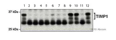 Western blot - Anti-TIMP1 antibody - Carboxyterminal end (AB38978)