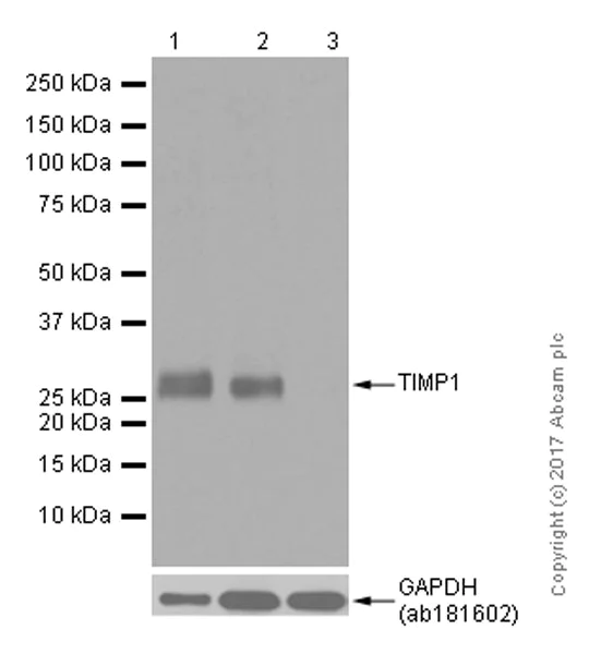 Western blot - Anti-TIMP1 antibody [EPR1550] (AB109125)