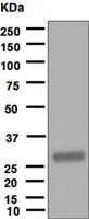 Western blot - Anti-TIMP1 antibody [EPR1550] (AB109125)