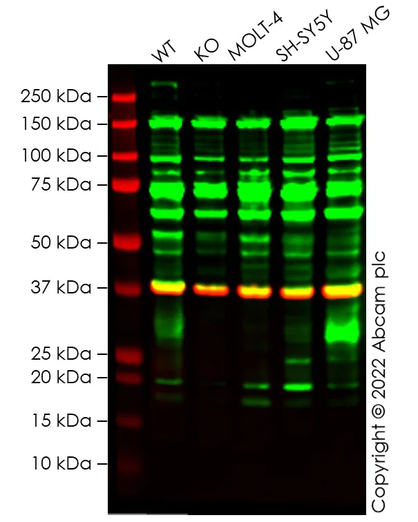 Western blot - Anti-TIMP1 antibody [EPR1550] (AB109125)