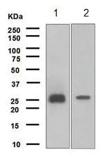 Western blot - Anti-TIMP1 antibody [EPR1550] (AB109125)