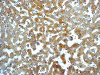 Immunohistochemistry (Formalin/PFA-fixed paraffin-embedded sections) - Anti-TIMP1 antibody [EPR1550] - BSA and Azide free (AB240504)
