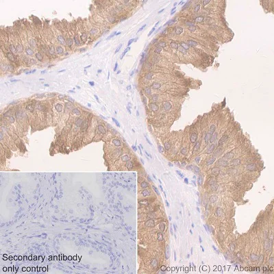 Immunohistochemistry (Formalin/PFA-fixed paraffin-embedded sections) - Anti-TIMP1 antibody [EPR1550] - BSA and Azide free (AB240504)