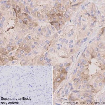 Immunohistochemistry (Formalin/PFA-fixed paraffin-embedded sections) - Anti-TIMP1 antibody [EPR1550] - BSA and Azide free (AB240504)