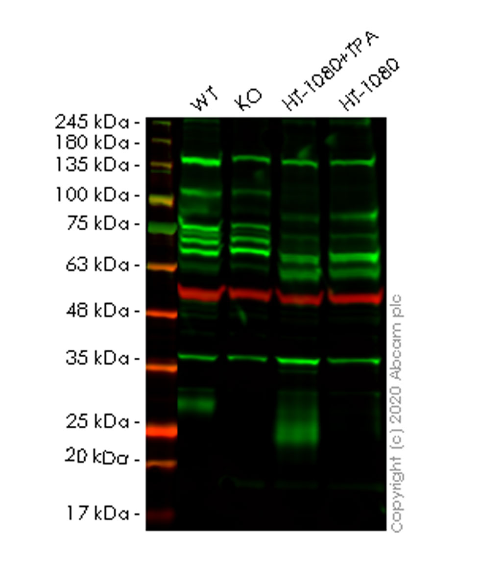Western blot - Anti-TIMP1 antibody [EPR1550] - BSA and Azide free (AB240504)