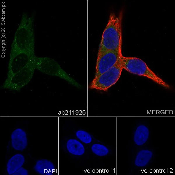 Immunocytochemistry/ Immunofluorescence - Anti-TIMP1 antibody [EPR18352] (AB211926)