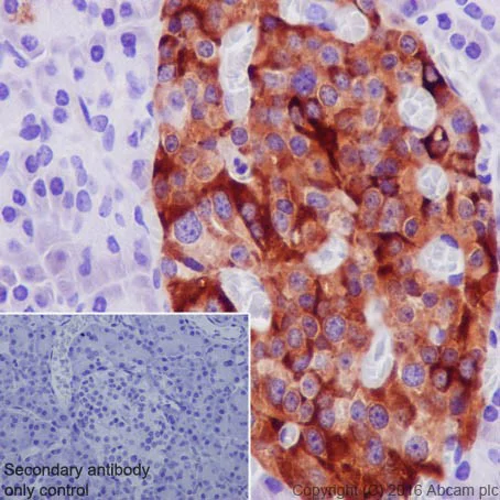Immunohistochemistry (Formalin/PFA-fixed paraffin-embedded sections) - Anti-TIMP1 antibody [EPR18352] (AB211926)