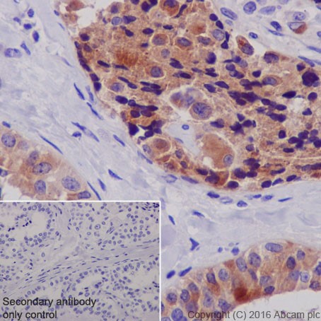 Immunohistochemistry (Formalin/PFA-fixed paraffin-embedded sections) - Anti-TIMP1 antibody [EPR18352] (ab211926), expandable thumbnail