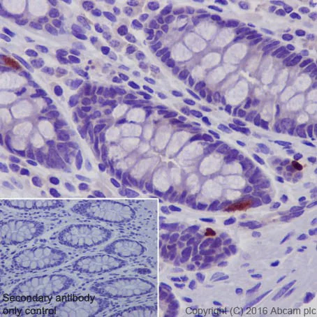 Immunohistochemistry (Formalin/PFA-fixed paraffin-embedded sections) - Anti-TIMP1 antibody [EPR18352] (AB211926)