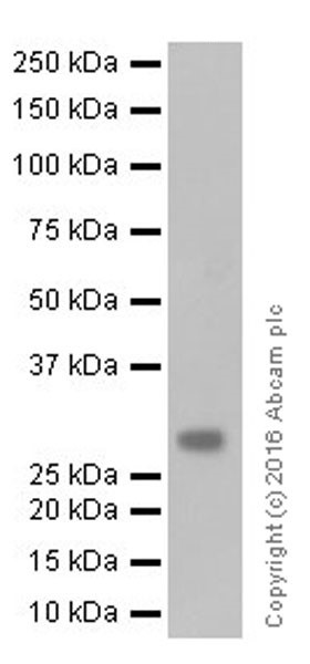 Western blot - Anti-TIMP1 antibody [EPR18352] (AB211926), expandable thumbnail