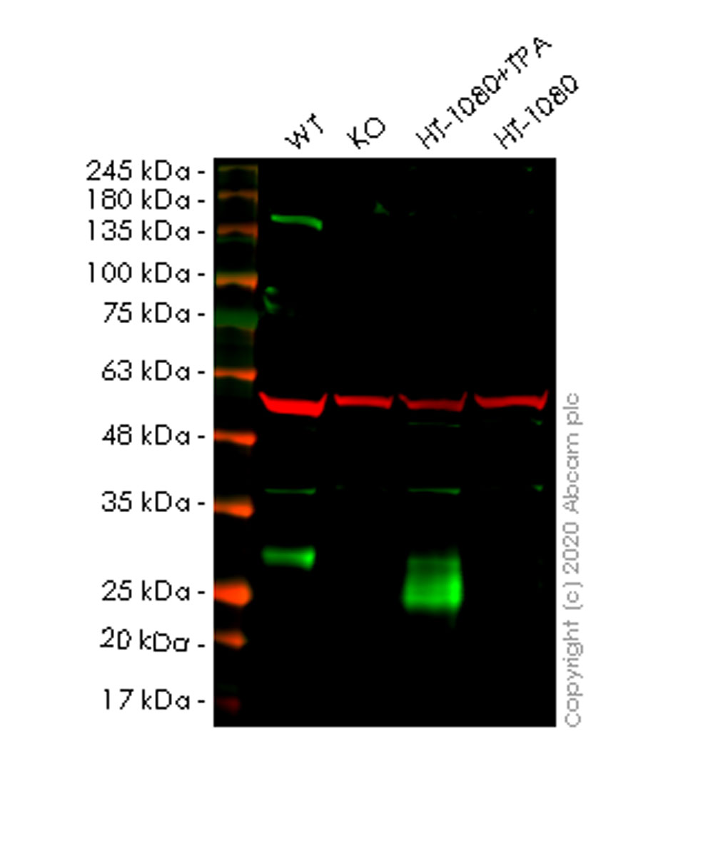 Western blot - Anti-TIMP1 antibody [EPR18352] (AB211926), expandable thumbnail