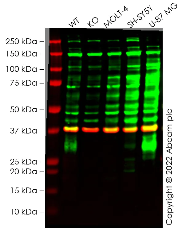 Western blot - Anti-TIMP1 antibody [EPR18352] (AB211926)