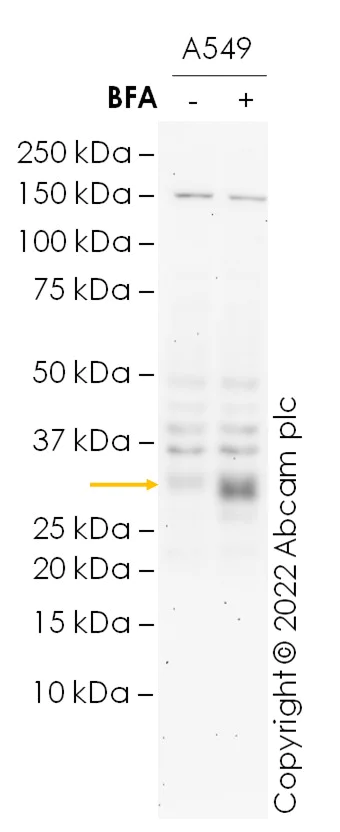 Western blot - Anti-TIMP1 antibody [EPR18352] (AB211926)