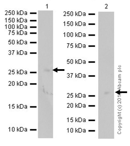 Western blot - Anti-TIMP1 antibody [EPR18352] (AB211926), expandable thumbnail