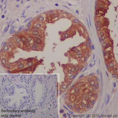 Immunohistochemistry (Formalin/PFA-fixed paraffin-embedded sections) - Anti-TIMP1 antibody [EPR18352] - BSA and Azide free (AB219471)