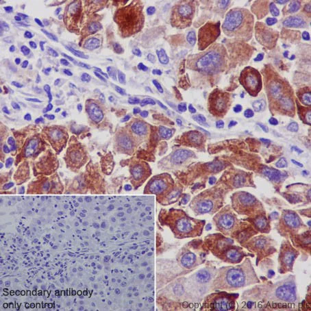 Immunohistochemistry (Formalin/PFA-fixed paraffin-embedded sections) - Anti-TIMP1 antibody [EPR18352] - BSA and Azide free (AB219471)