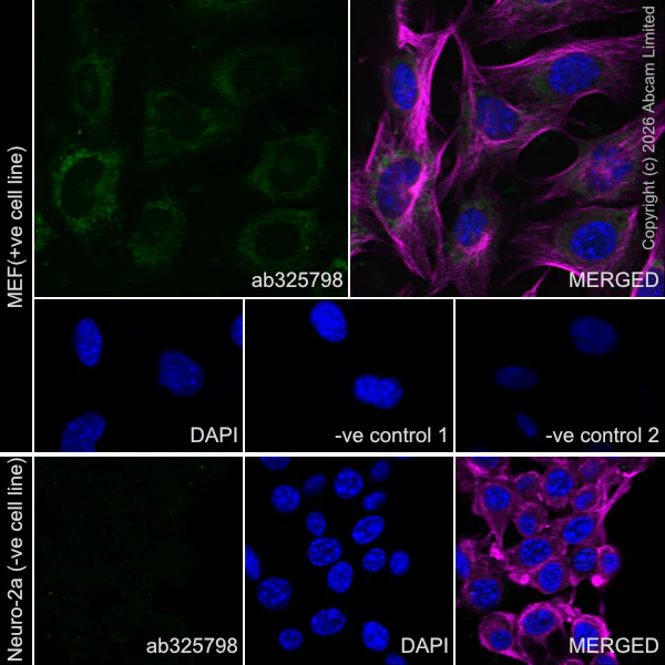 Immunocytochemistry/ Immunofluorescence - Anti-TIMP1 antibody [EPR30559-561] (AB325798)
