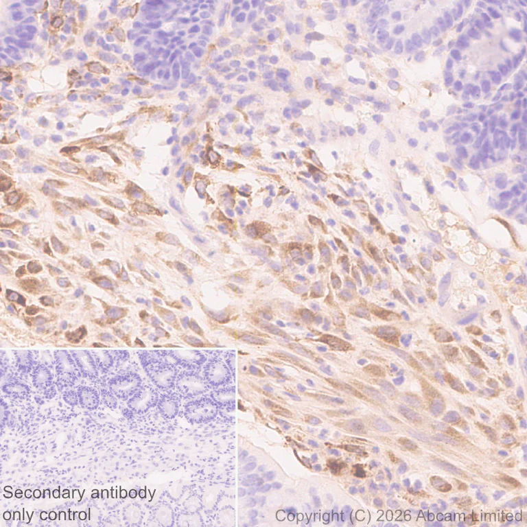 Immunohistochemistry (Formalin/PFA-fixed paraffin-embedded sections) - Anti-TIMP1 antibody [EPR30559-561] (AB325798)