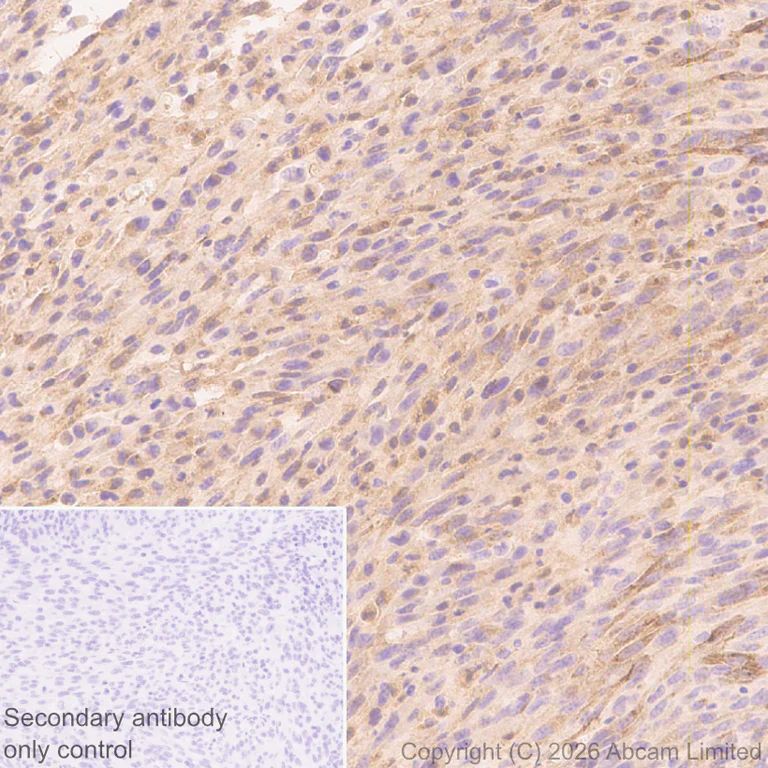Immunohistochemistry (Formalin/PFA-fixed paraffin-embedded sections) - Anti-TIMP1 antibody [EPR30559-561] (AB325798)