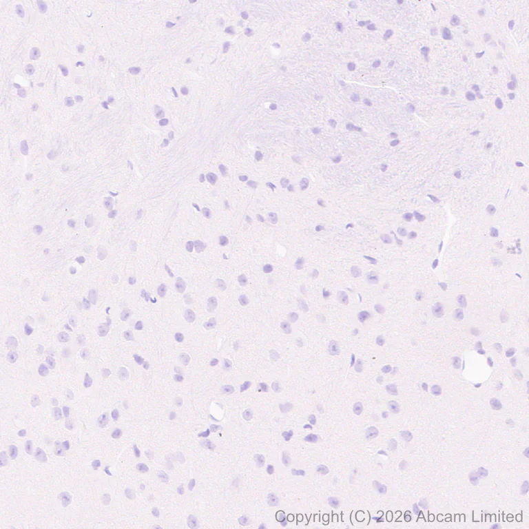 Immunohistochemistry (Formalin/PFA-fixed paraffin-embedded sections) - Anti-TIMP1 antibody [EPR30559-561] (AB325798)