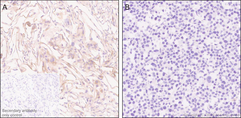 Immunohistochemistry (Formalin/PFA-fixed paraffin-embedded sections) - Anti-TIMP1 antibody [EPR30559-561] (AB325798)