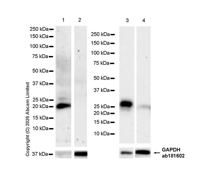 Western blot - Anti-TIMP1 antibody [EPR30559-561] (AB325798)