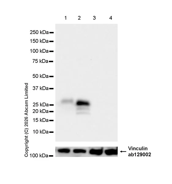 Western blot - Anti-TIMP1 antibody [EPR30559-561] (AB325798)
