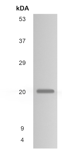 Western blot - Anti-TIMP1 antibody [RM0136-6A34] (AB86482), expandable thumbnail