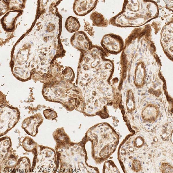 Immunohistochemistry (Formalin/PFA-fixed paraffin-embedded sections) - Anti-TIMP2 antibody [3A4] (AB1828)