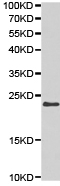 Western blot - Anti-TIMP2 antibody (AB180630), expandable thumbnail