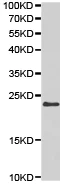Western blot - Anti-TIMP2 antibody (AB180630)