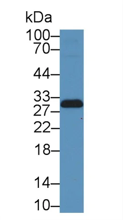 Western blot - Anti-TIMP2 antibody (AB231176)