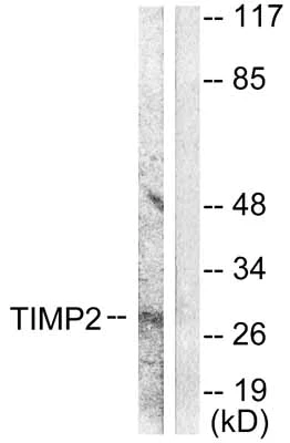 Western blot - Anti-TIMP2 antibody (AB53730)