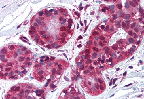 Immunohistochemistry (Formalin/PFA-fixed paraffin-embedded sections) - Anti-TIMP2 antibody [F27P3A4] (AB230511)