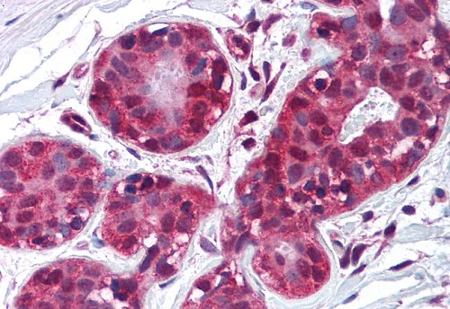 Immunohistochemistry (Formalin/PFA-fixed paraffin-embedded sections) - Anti-TIMP2 antibody [F27P3A4] (AB230511)