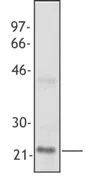 Western blot - Anti-TIMP2 antibody [F27P3A4] (AB230511)
