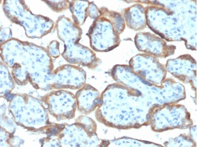 Immunohistochemistry (Formalin/PFA-fixed paraffin-embedded sections) - Anti-TIMP2 antibody [TIMP2/2044] (AB238062)
