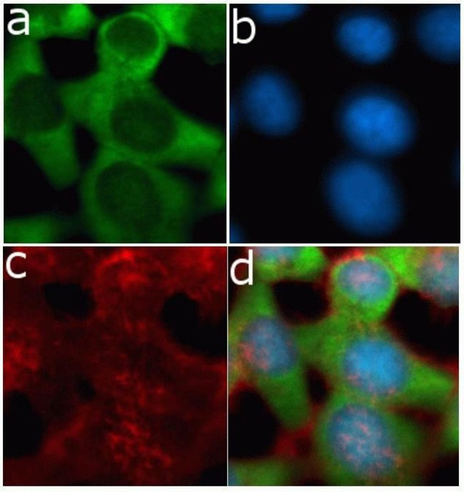 Immunocytochemistry - Anti-TIMP3 antibody [20HCLC] (AB277794)
