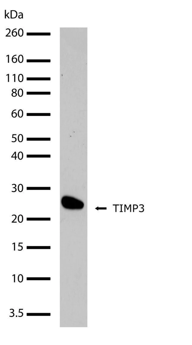 Western blot - Anti-TIMP3 antibody [20HCLC] (AB277794)