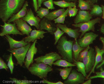 Immunocytochemistry/ Immunofluorescence - Anti-TIMP3 antibody (AB39184), expandable thumbnail