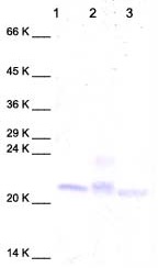 Western blot - Anti-TIMP3 antibody (AB39184), expandable thumbnail