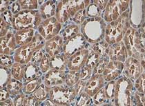 Immunohistochemistry (Formalin/PFA-fixed paraffin-embedded sections) - Anti-TIMP3 antibody (AB93637)