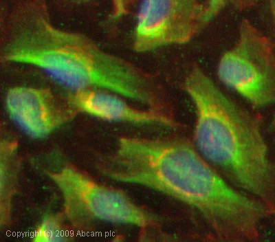 Immunocytochemistry/ Immunofluorescence - Anti-TIMP3 antibody - Carboxyterminal end (AB39185)