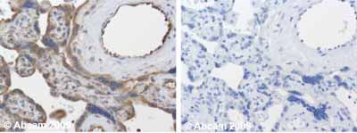 Immunohistochemistry (Formalin/PFA-fixed paraffin-embedded sections) - Anti-TIMP3 antibody - Carboxyterminal end (AB39185)