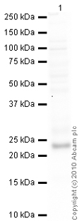 Western blot - Anti-TIMP3 antibody - Carboxyterminal end (AB39185)