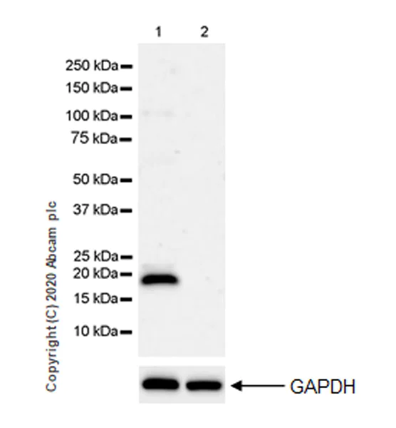 Western blot - Anti-TIMP3 antibody [EPR23943-149] (AB276134)