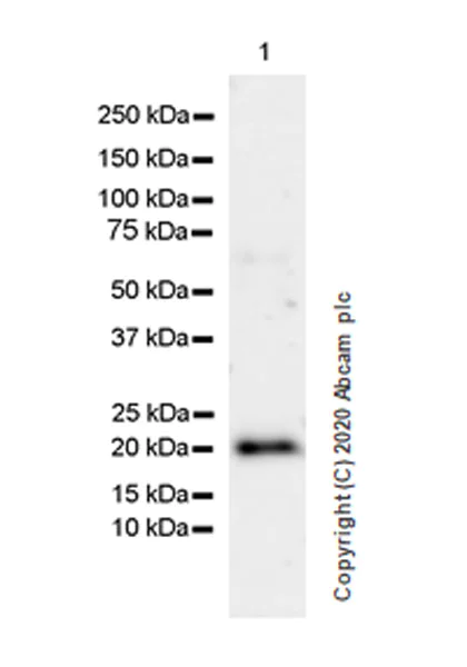 Western blot - Anti-TIMP3 antibody [EPR23943-149] (AB276134)