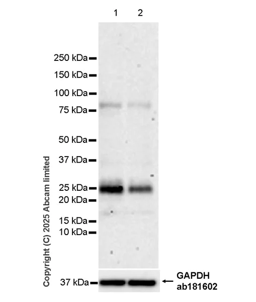 Western blot - Anti-TIMP3 antibody [EPR30560-53] (AB325141)
