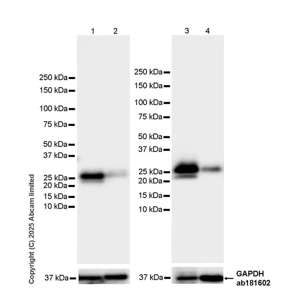 Western blot - Anti-TIMP3 antibody [EPR30560-53] (AB325141)